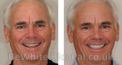Kojic acid cream for Ugandan