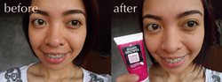 Skin brightening for Black Trinidadians