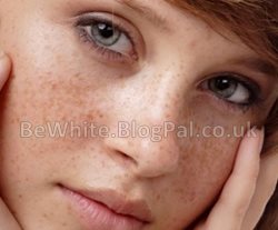 Skin whitening treatments for Congo