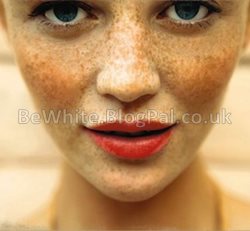 Skin whitening body cream for Malawian people