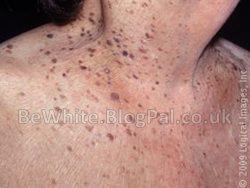 The best skin lightening cream for Nigerian women