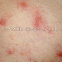 Lightening arm creams for Asian