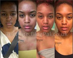 Natural skin lighteners for Ugandan men