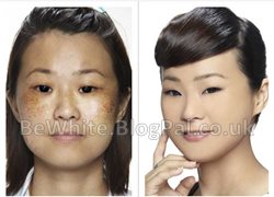 Lightening black skin creams for Congo