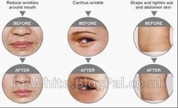 Body cream whitening for Nigerian men