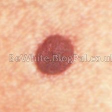Skin lightening cream uk for Congo woman