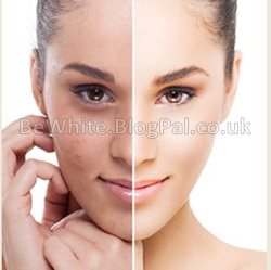 Bleaching face creams for Malawian people