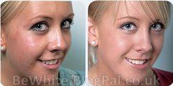 Face whitening for Ghana