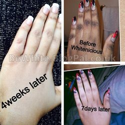 Asian skin whitening cream for Trinidadians men
