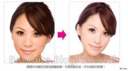 Best skin whitening creams for Uganda woman