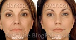 Natural whitening skin for Zimbabwe women