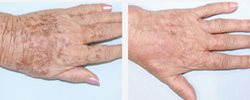 Whitening arm cream for South African women