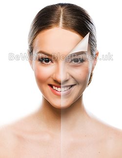 Whitening treatment for Indian woman