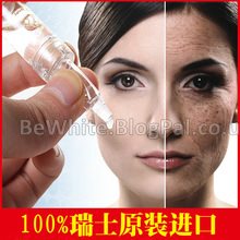Skin lightening treatments for Nigerian men